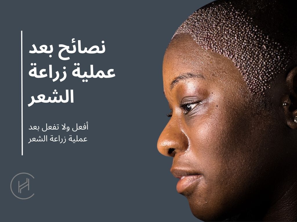 نصائح_بعد-عملية-زراعة-الشعر