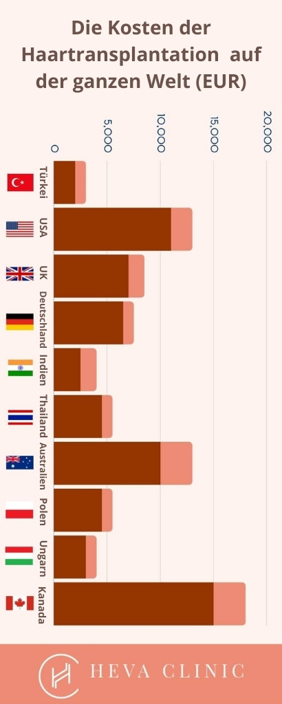 Die Kosten der haartransplantation auf der ganzen Welt (EUR)