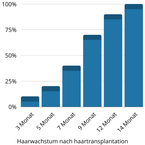 Haarwachstum nach haartransplantation - 3 - 14 Monat