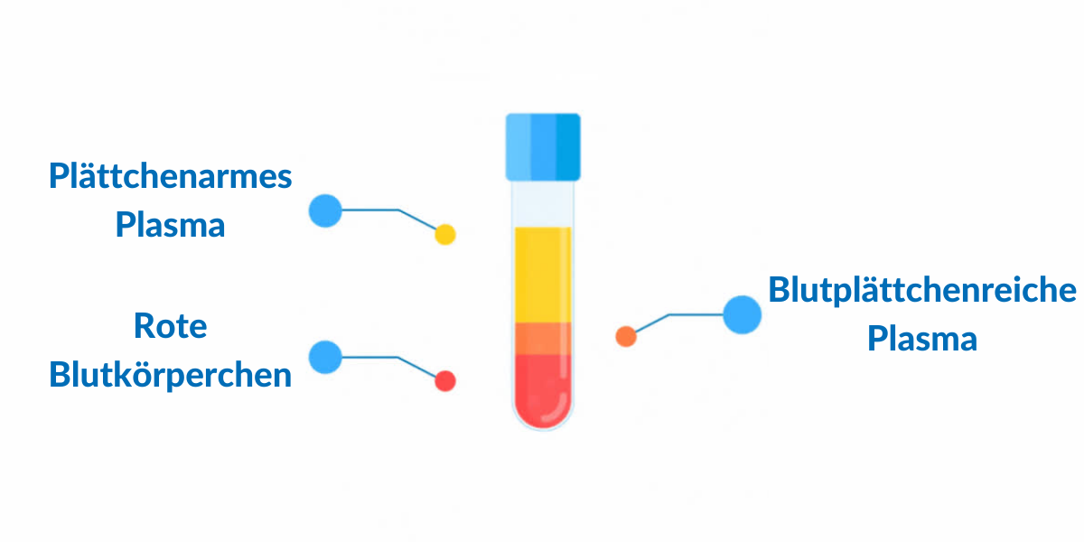 Plättchenarmes Plasma - Rote Blutkörperchen -Blutplättchenreiche Plasma