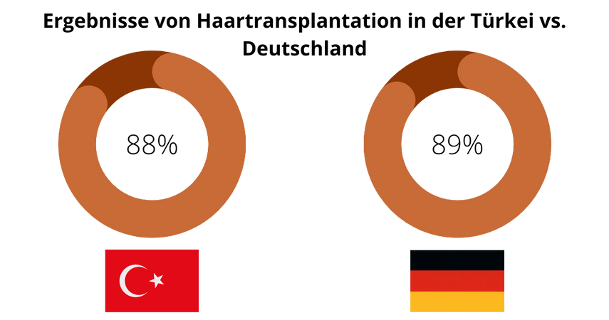 Ergebnisse von Haartransplantation in der Türkei vs. Deutschland