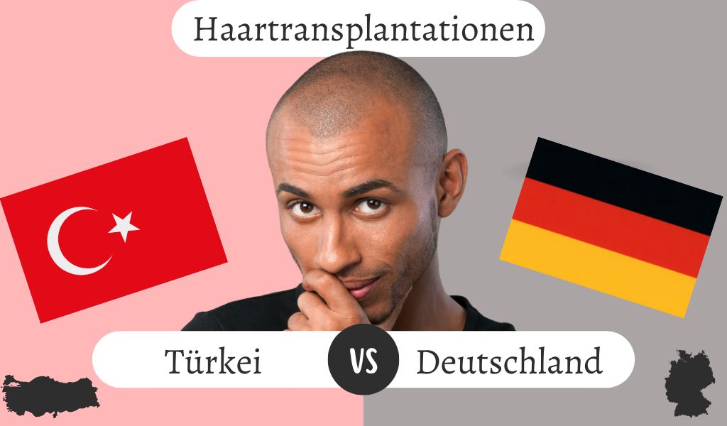Haartransplantationen in Deutschland vs. Türkei