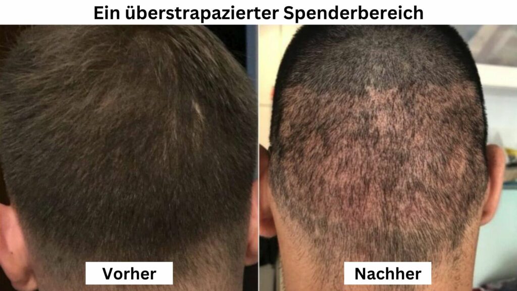 Ein überstrapazierter Spenderbereich