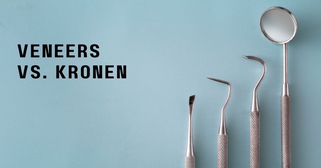 Veneers-versus-Kronen