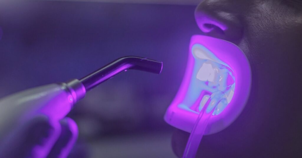 Zahnaufhellung in der Klinik violettes Licht