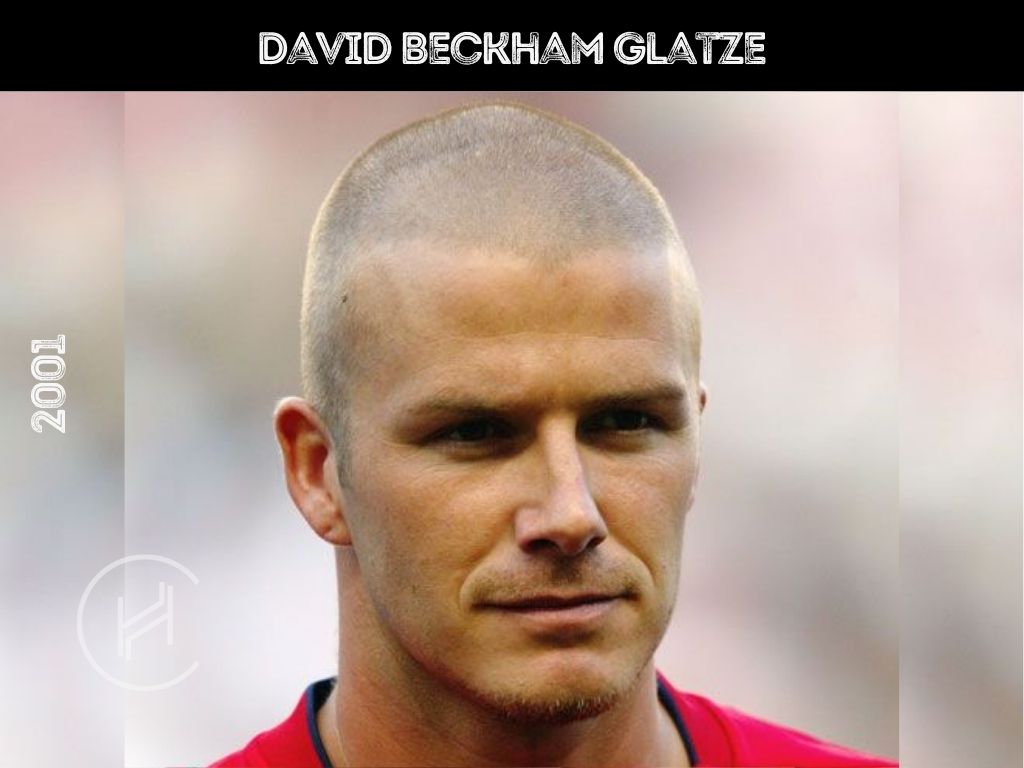 david beckham glatze