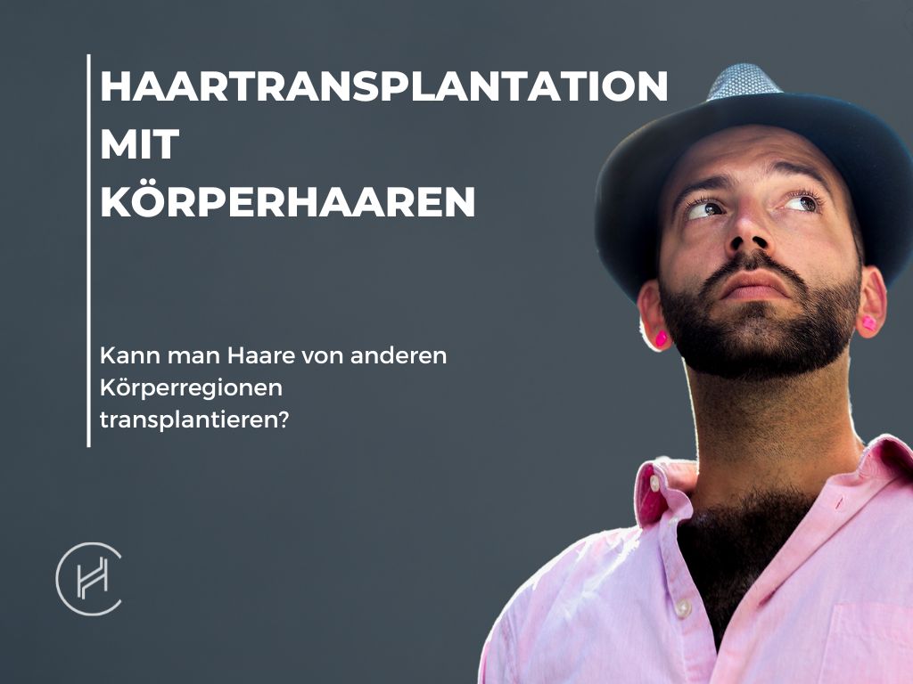 Haartransplantation-mit-Körperhaaren-banner