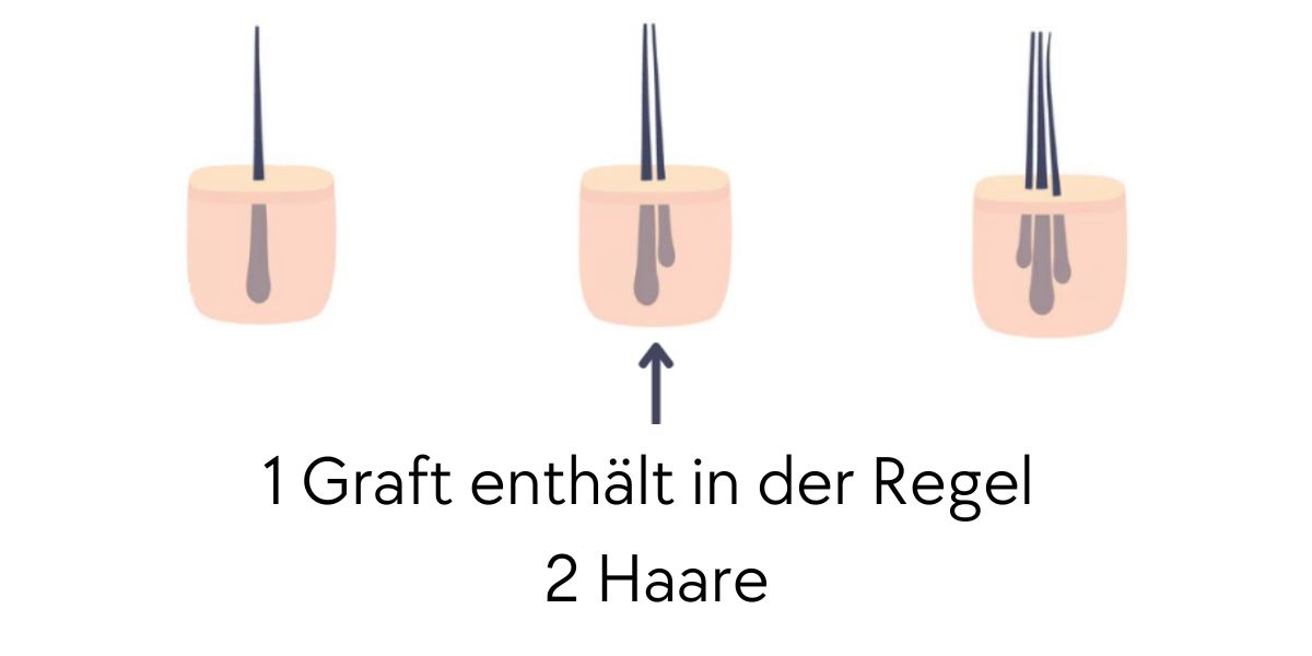 1 Graft enthält in der Regel 2 Haare