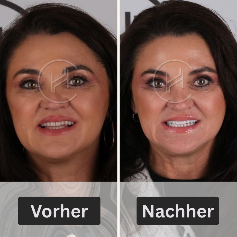Dentalbetrieb des weiblichen Lächelns führt in der Türkei in Hevadent