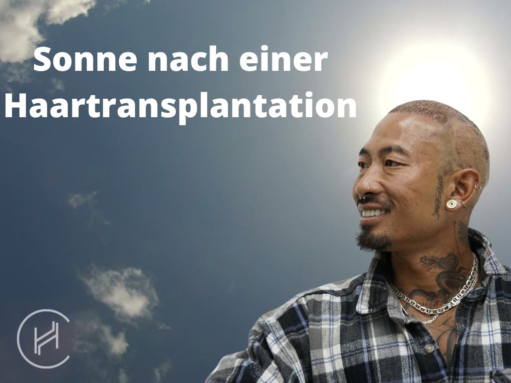 Sonne nach einer Haartransplantation