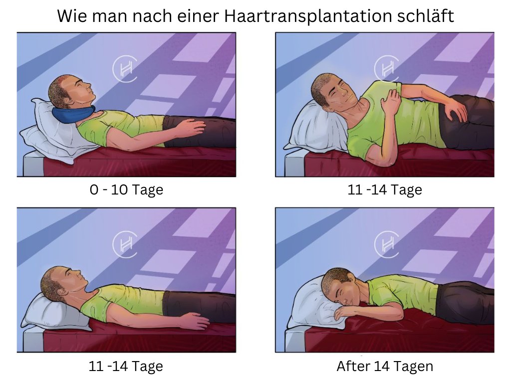 Wie man nach einer Haartransplantation schläft