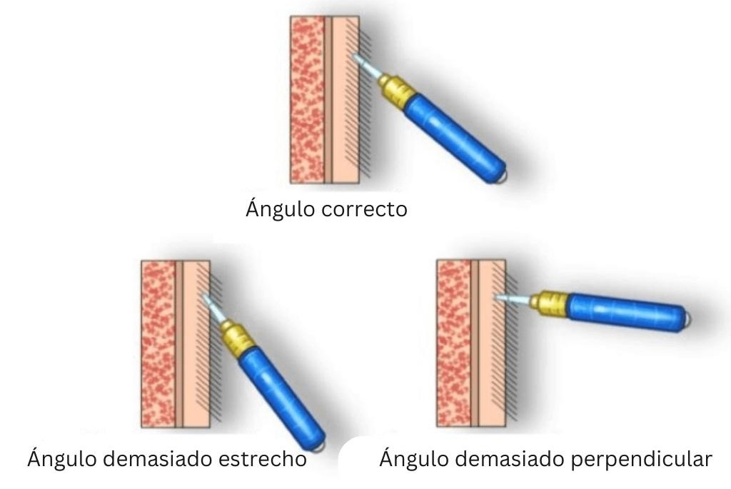 Ángulo transplante capilar