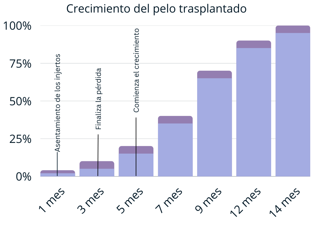 Crecimiento del pelo trasplantado para mujer