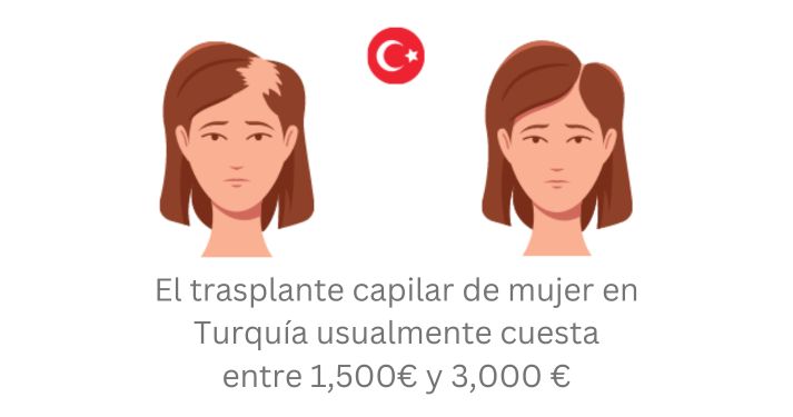 Precio de trasplante capilar de mujer en Turquía
