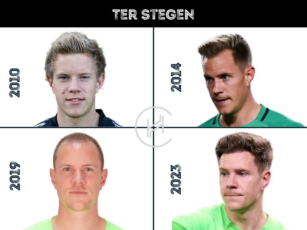 Perdida de cabello Ter Stegen