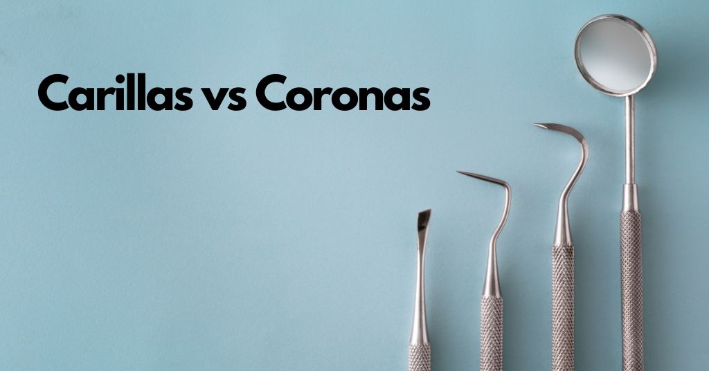 carillas vs coronas