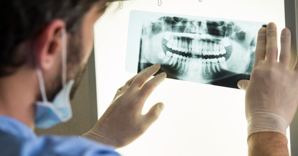 procedimiento de implante dental