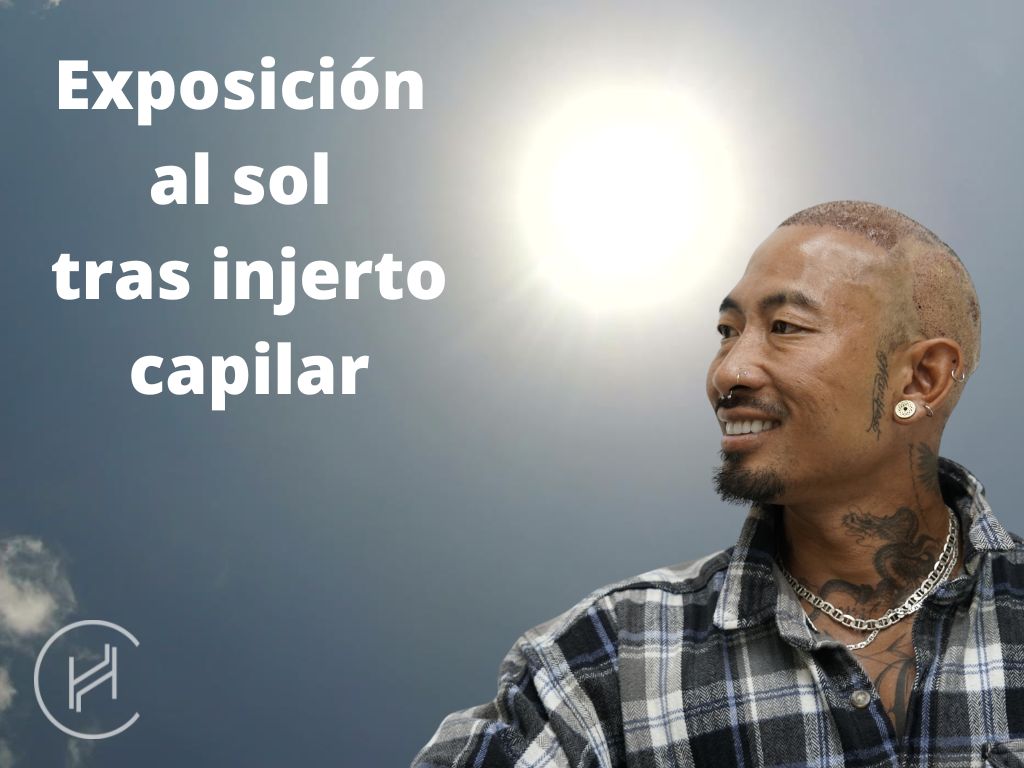 Exposición al sol tras injerto capilar