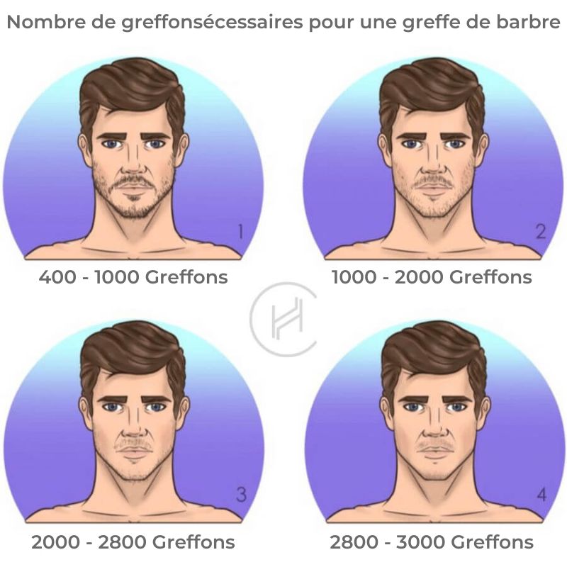 Nombre de greffonsécessaires pour une greffe de barbre