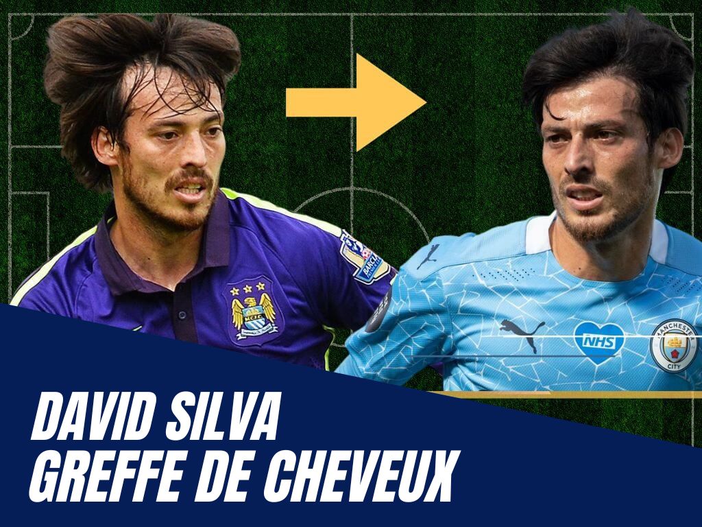 David Silva Greffe de Cheveux
