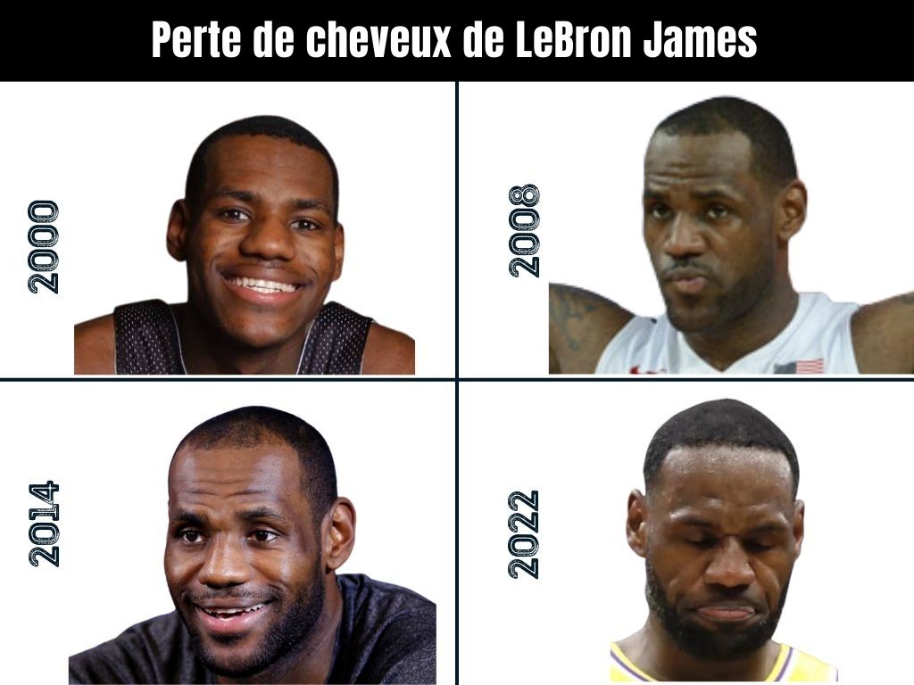 LeBron James Greffe De Cheveux Perte De Cheveux Et Analyse Technique lebron-james-greffe-de-cheveux-perte-de-cheveux-et-analyse-technique