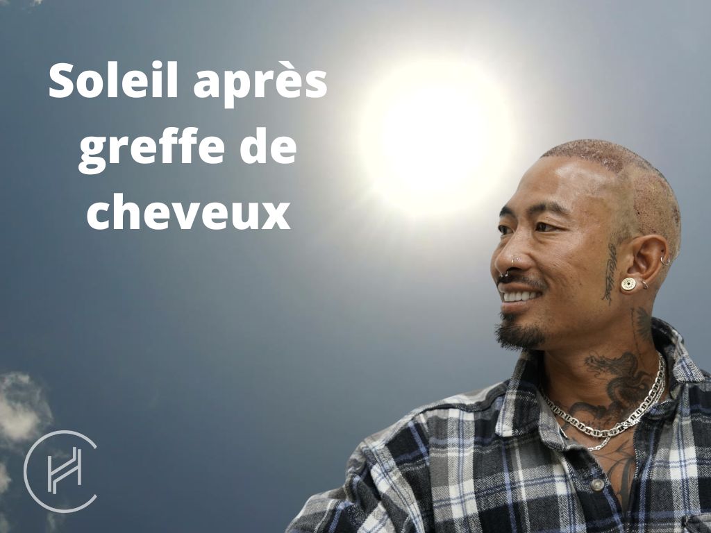 Soleil après greffe de cheveux