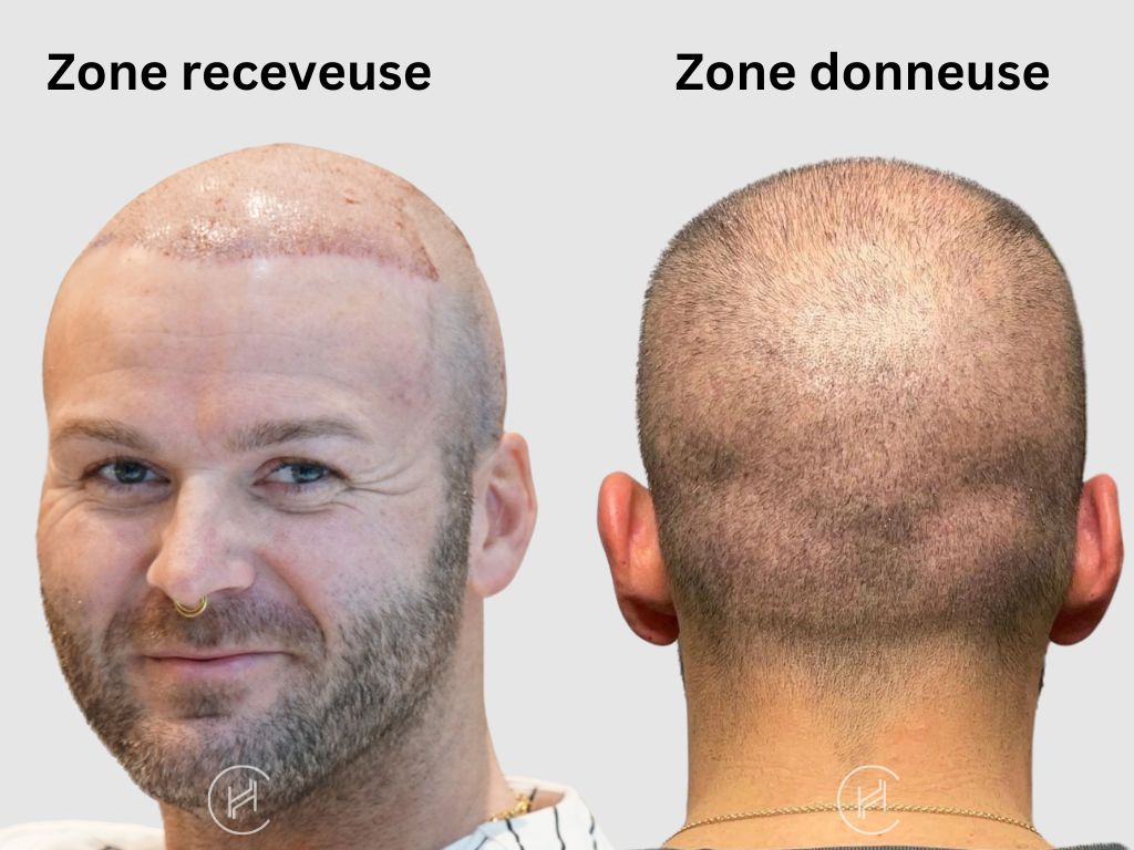 Zone receveuse - Zone donneuse