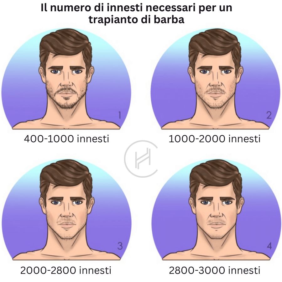 Numero-di-innesti-necessari-per-il-trapianto-di-barba