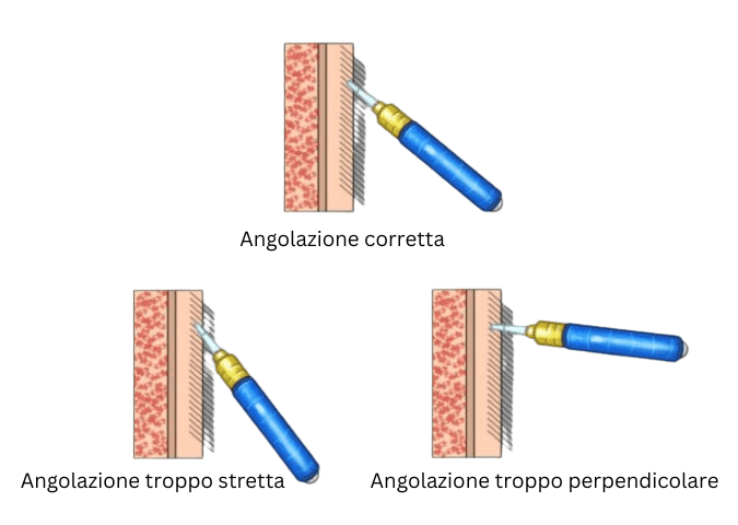 angolazione di crescita dei capelli heva