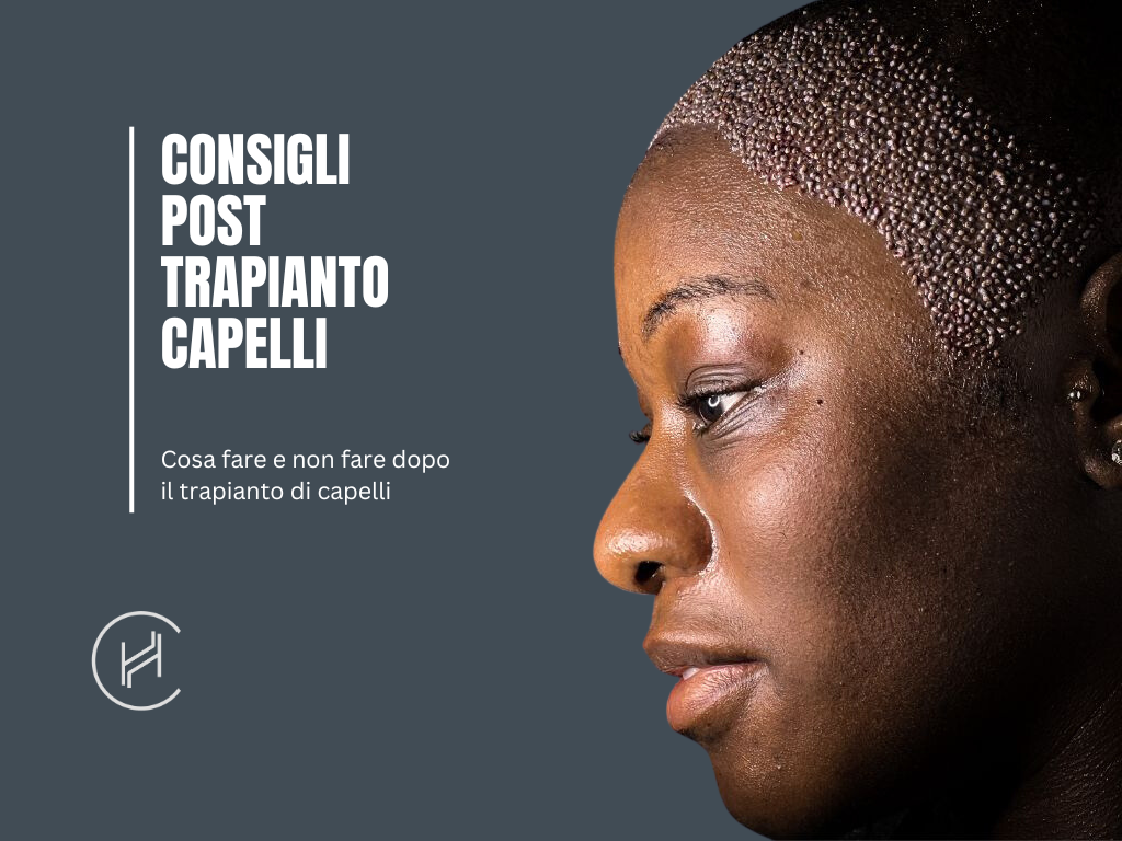 post operatorio trapianto capelli