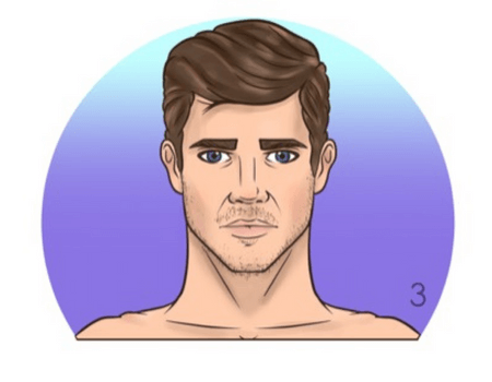 trapianto-di-barba-caso-3