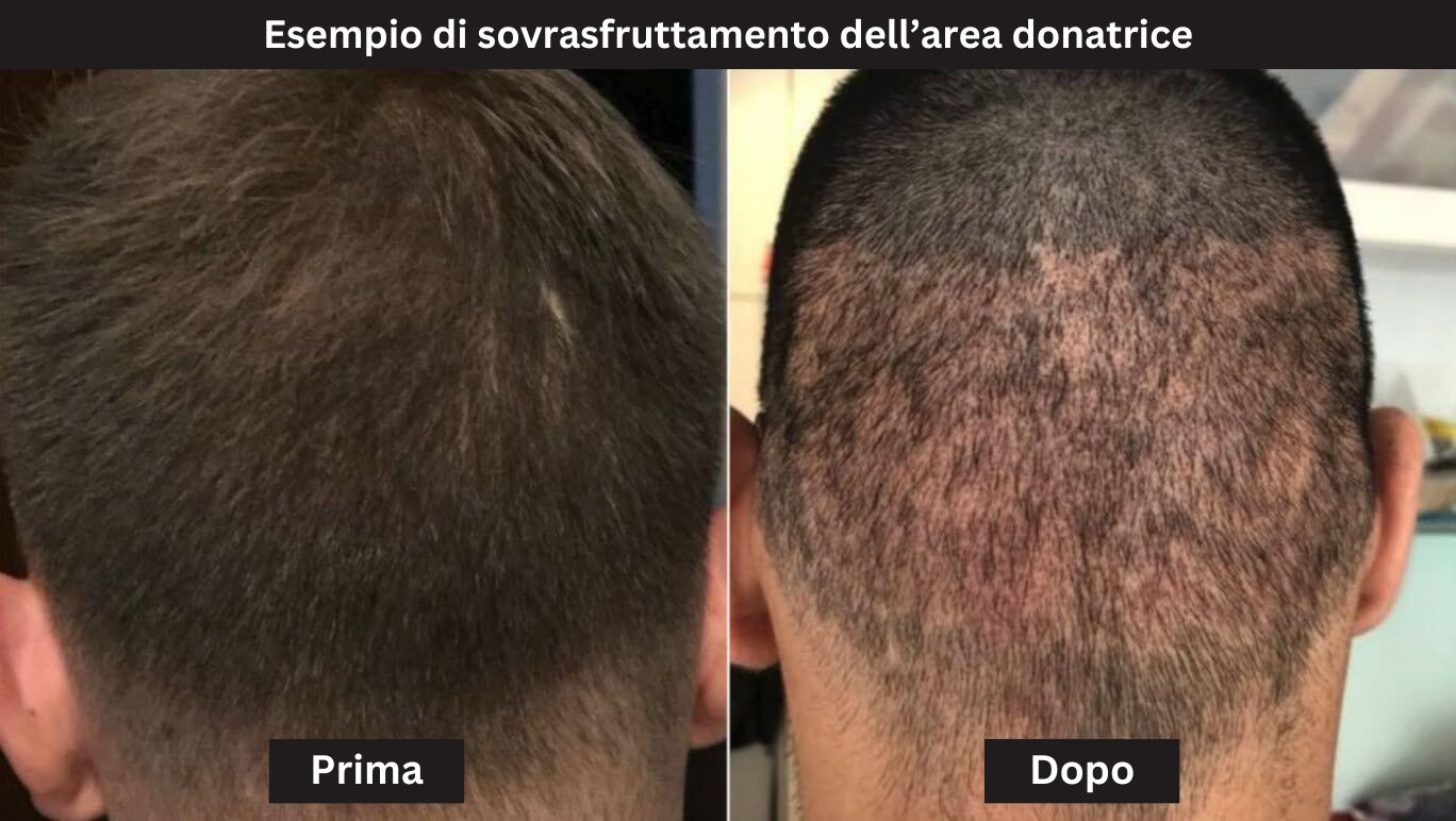foto di sovrasfruttamento dell’area donatrice overharvesting