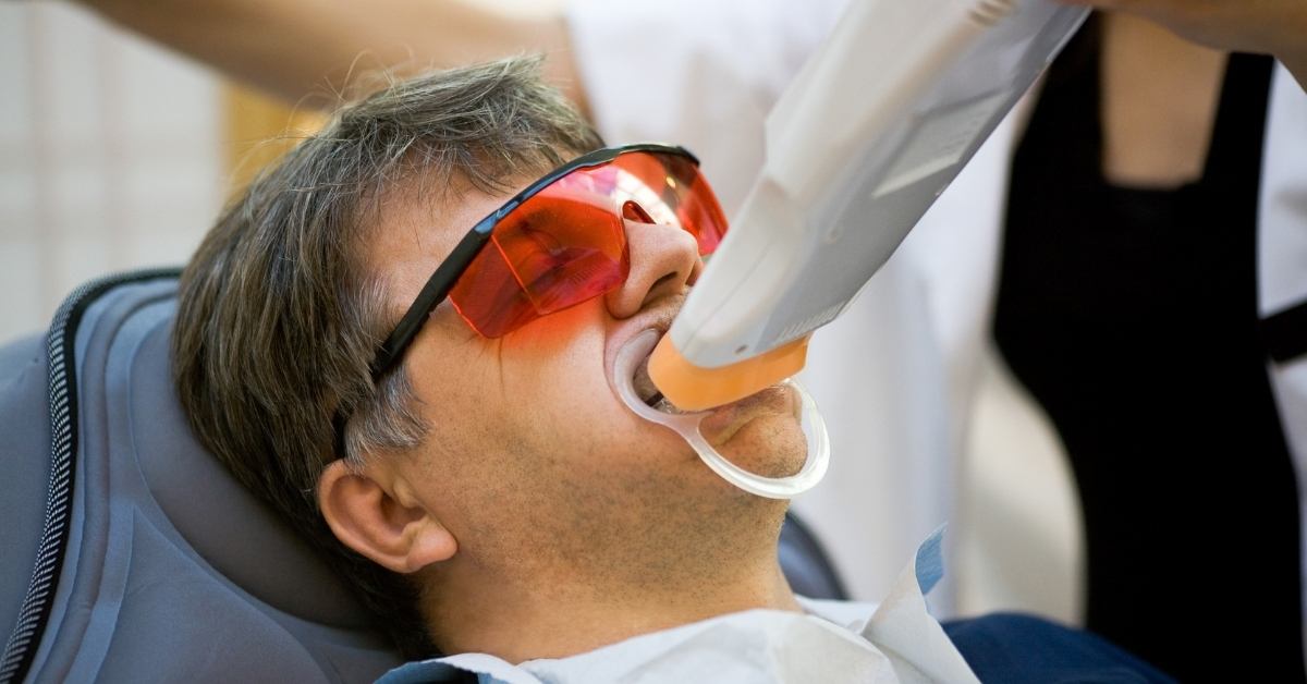man teeth whitening process