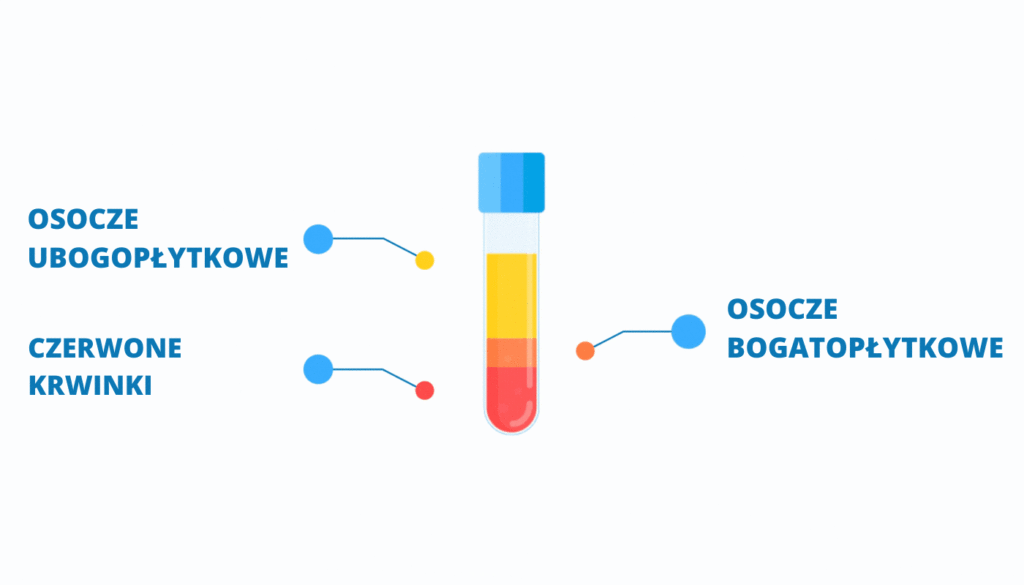 Osocze Bogatopłytkowe (PRP) gif