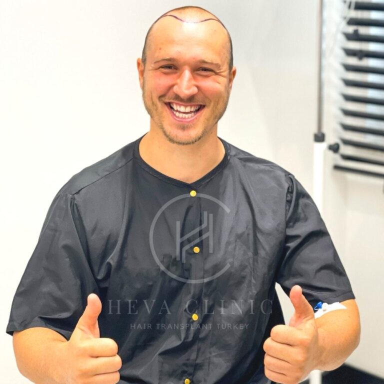 Młody mężczyzna w czarnym ubraniu przed przeszczepem włosów w Heva clinic