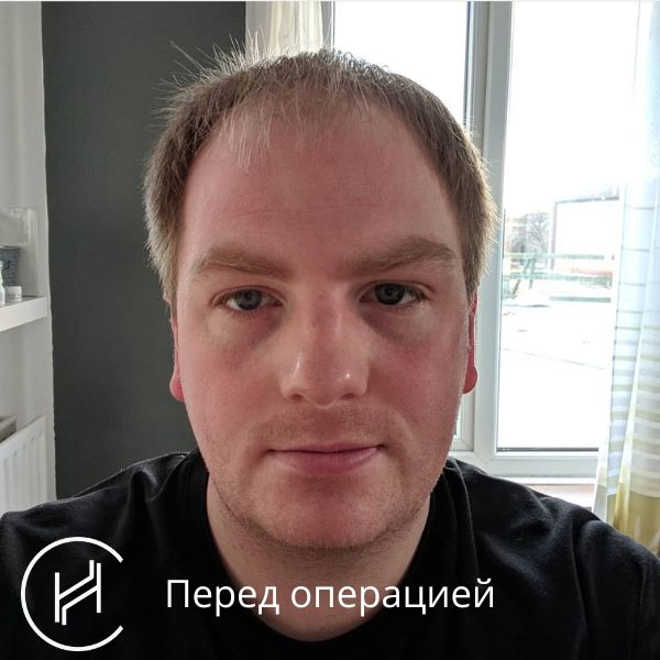 Перед операцией