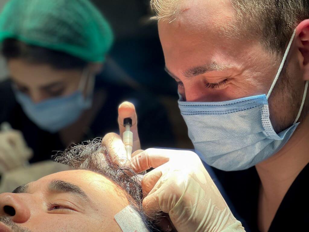 Процесс пересадки волос в Турции методом DHI