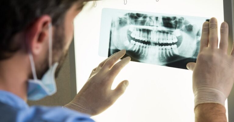 Зубные импланты в Турции – рентген