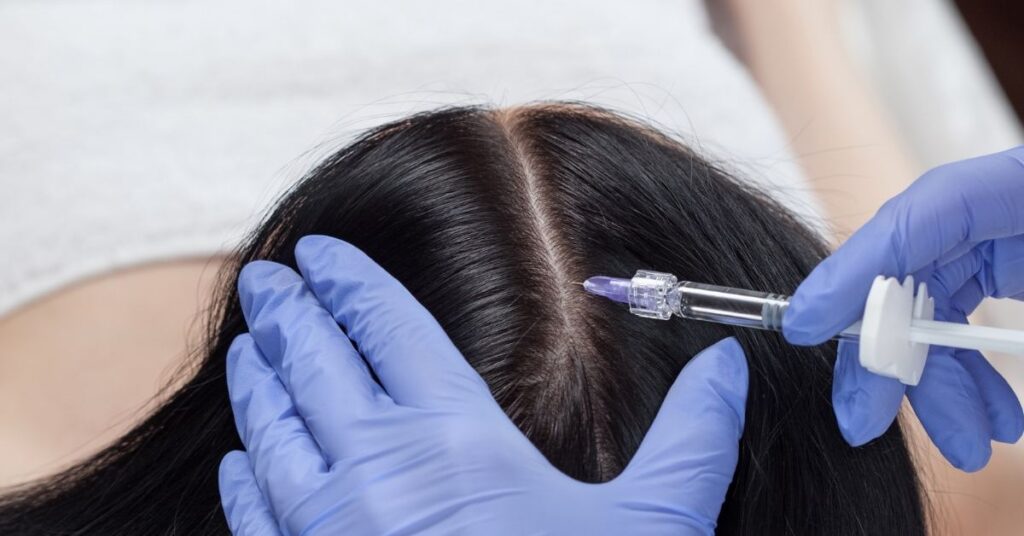 prp saç tedavisi kadın enjeksiyon