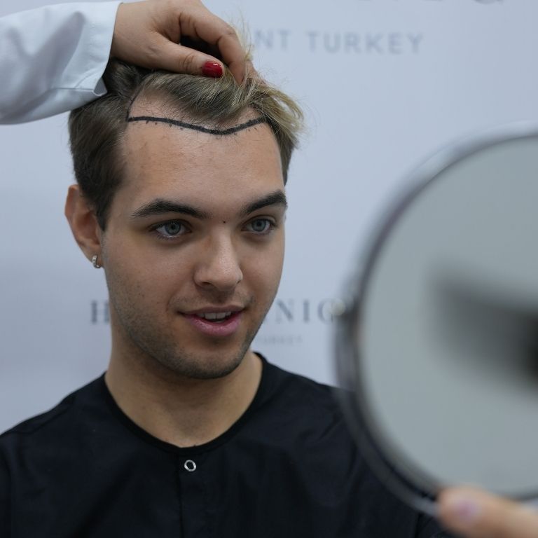 tıraşsız saç ekimi heva clinic istanbul