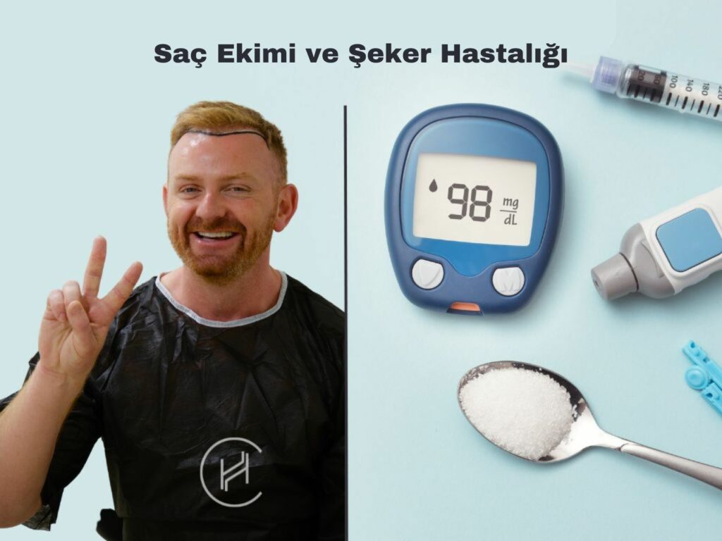 saç-ekimi-ve-şeker-hastalığı