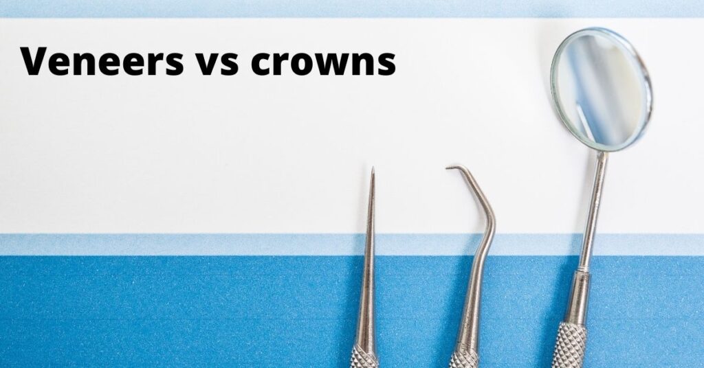 dental veneers vs crown comparison