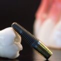 dental implant picture heva clinic logo
