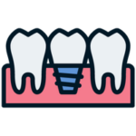 dental implant treatments