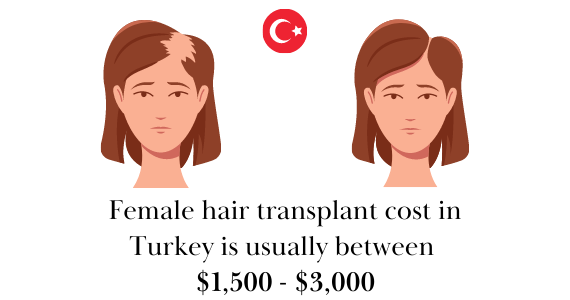 Female hair transplant cost in Turkey