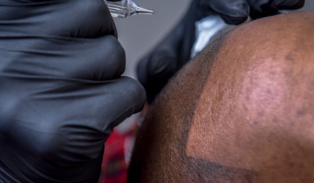 Scalp micropigmentation and tattooing process