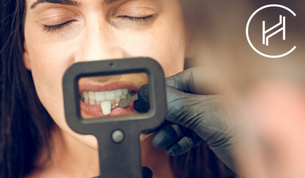 dental veneer operation turkey female patient heva clinic