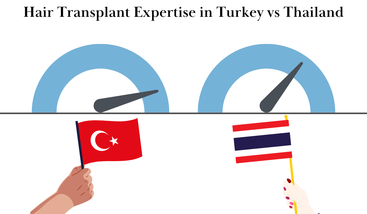 hair transplant expertise in turkey vs thailand
