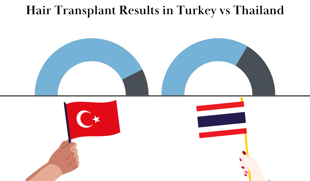hair transplant results in turkey vs thailand