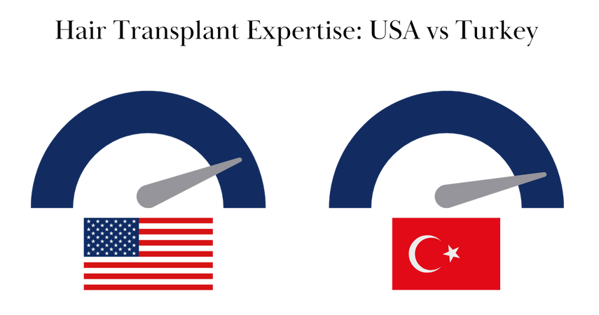 hair transplant expertise usa vs turkey